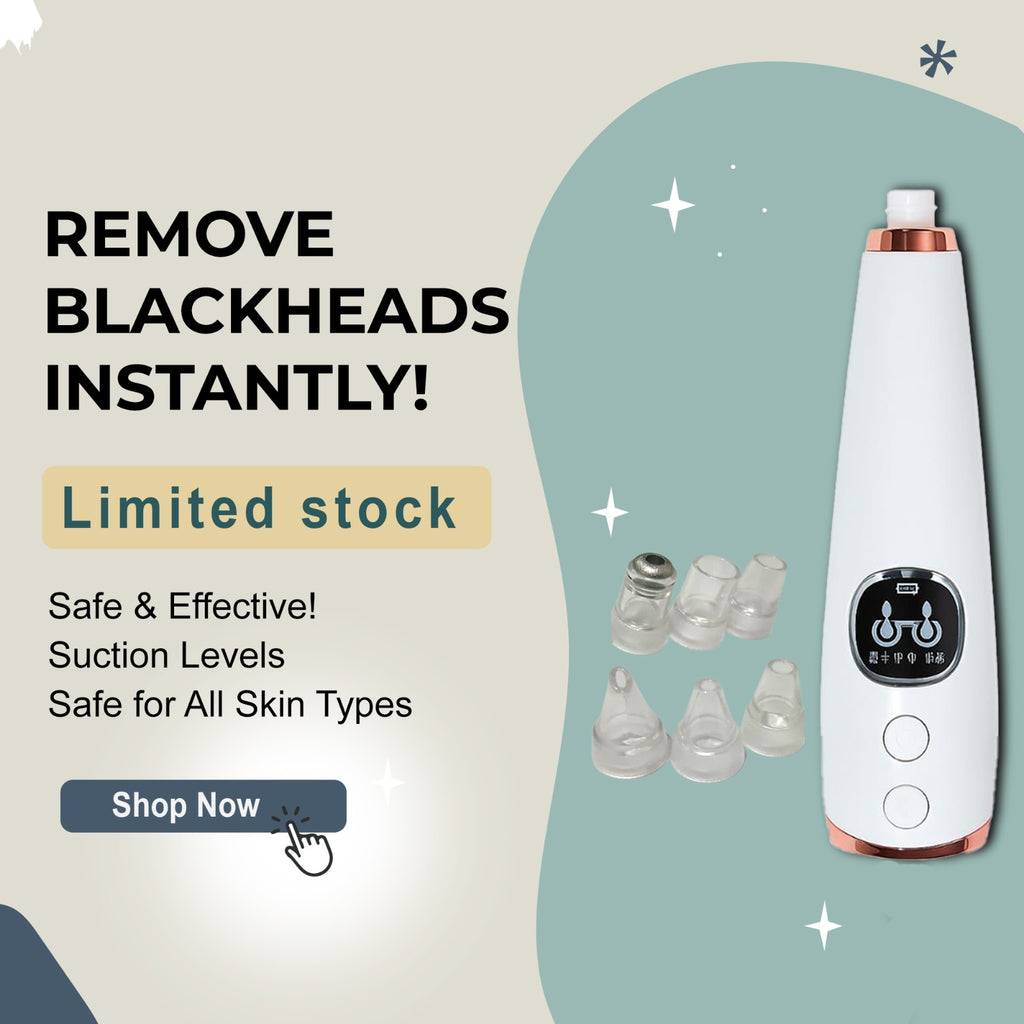Blackhead Remover – Instant Results, Clear Skin!"